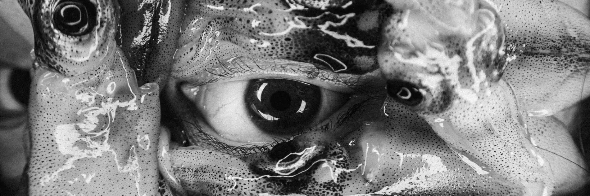 Black and white photo of eyeballs with biological matter around it